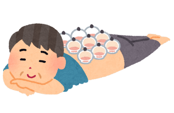 なごみ整骨院が吸角療法の東洋医学的な作用を簡単にご説明